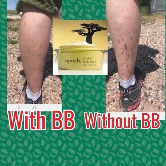 PRE-ORDER ONLY Stretch Mark & Multi-Tasking Cream - Picture 4 of 8